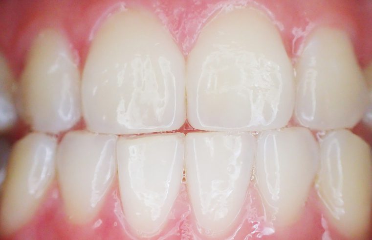 dentsta, stomatolog