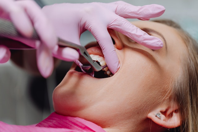 Czemu po wizycie u dentysty może występować ból zęba?
