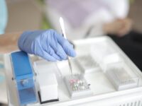Kiedy recesja dziąseł wymaga leczenia u periodontologa?